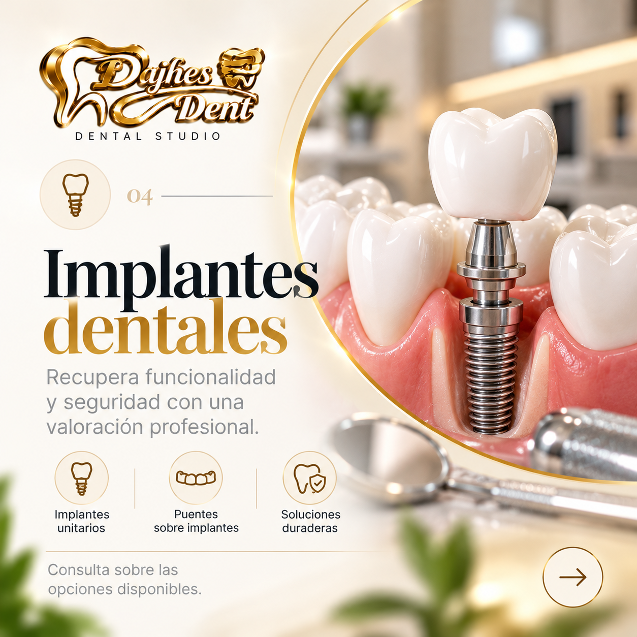Implantes dentales